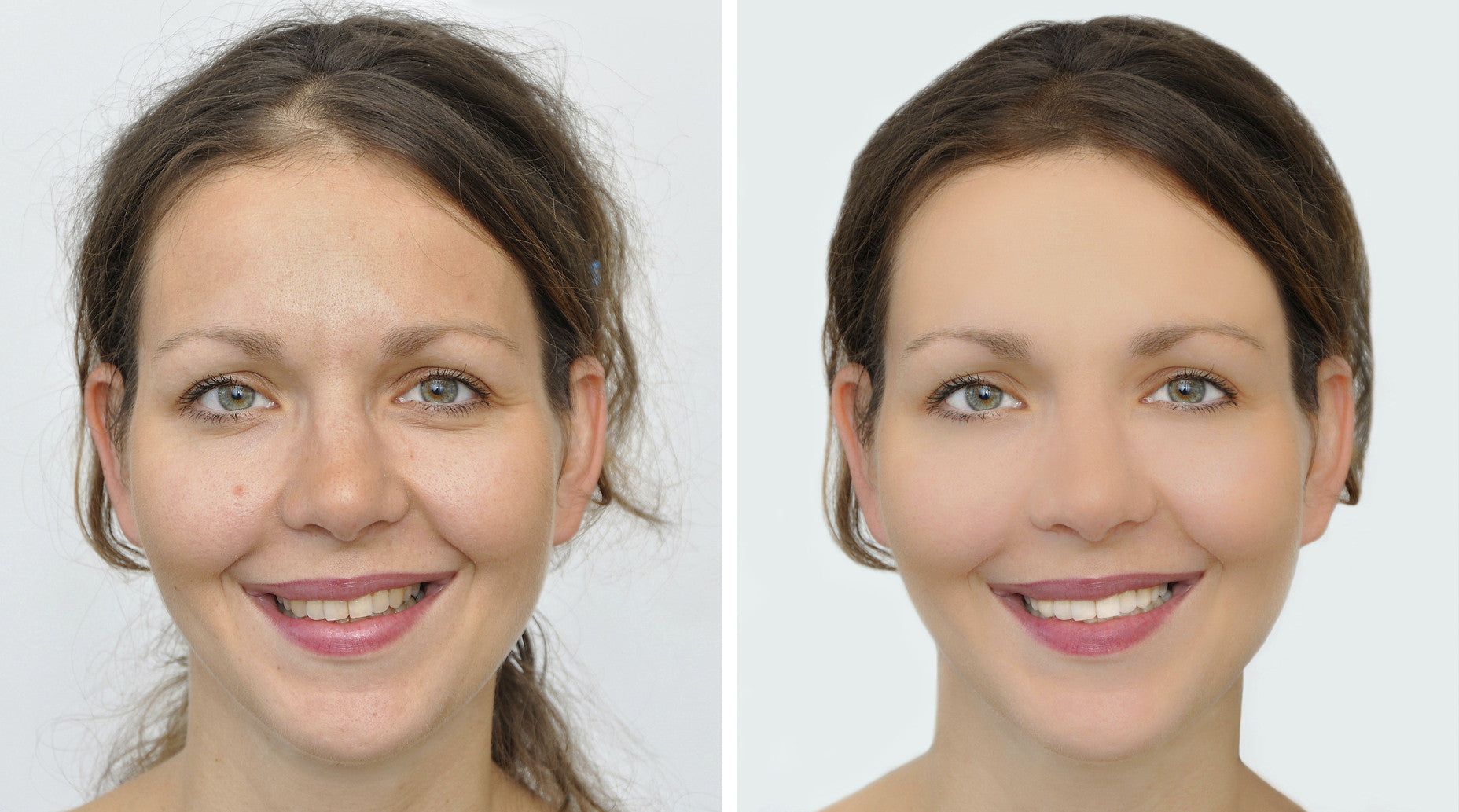 Upgrading Your Teenage Oily Skincare Routine to an Adult Routine